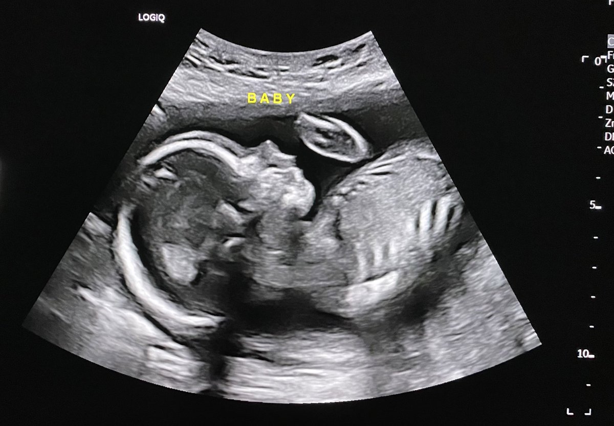 Allison MacNeil (She/Her) tweet media