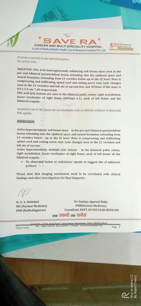 MishraBini's tweet photo. @himantabiswa @CMOfficeAssam শ্ৰদ্ধাৰ মুখ্যমন্ত্ৰী মহোদয়,
১১ বছৰীয়া কণমানি শিশুগৰাকী কৰ্কট ৰোগত আক্ৰান্ত।
শিশুগৰাকী উন্নত চিকিৎসাৰ বাবে আপোনাৰ সহায়ৰ প্ৰয়োজন। অতি দৰিদ্ৰ পৰিয়ালৰ শিশুগৰাকী চিকিৎসা প্ৰদানৰ বাবে নিজৰ যিখিনি আছিল সকলো শেষ কৰিছে পিতৃগৰাকীয়ে।
এই মৰমলগা শিশু গৰাকীক জীয়াই ৰখাৰ শেষ ভৰসা আপুনি। https://t.co/i3eOFshLER