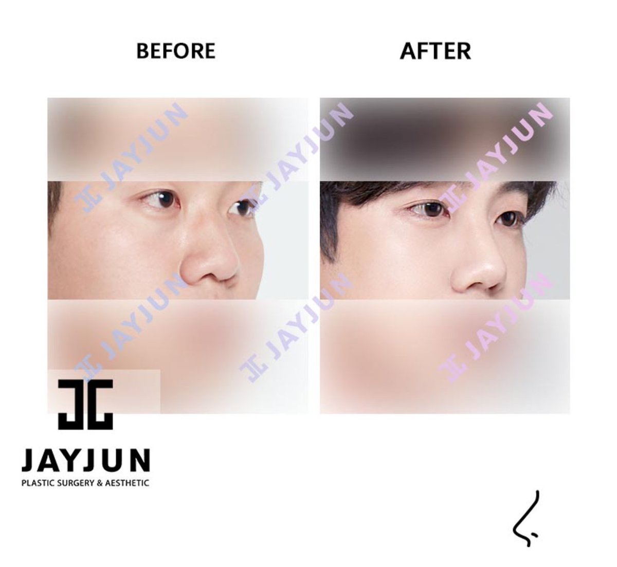 団子鼻のtwitterリアルタイム検索結果 Meyou ミーユー