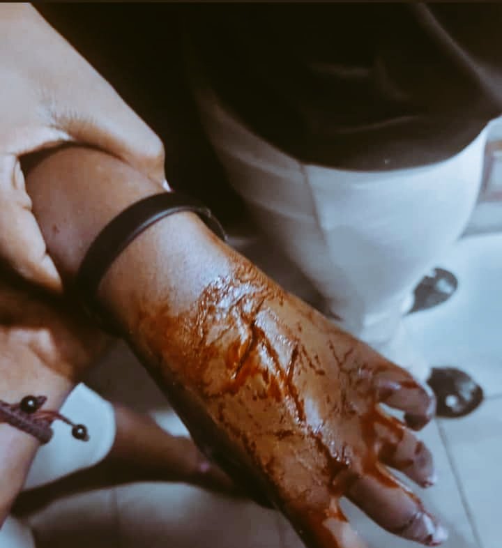 doxalenny's tweet photo. Fake wounds.

#fakewoundsseries #specialeffectsmakeup https://t.co/BrX6O8IzQQ