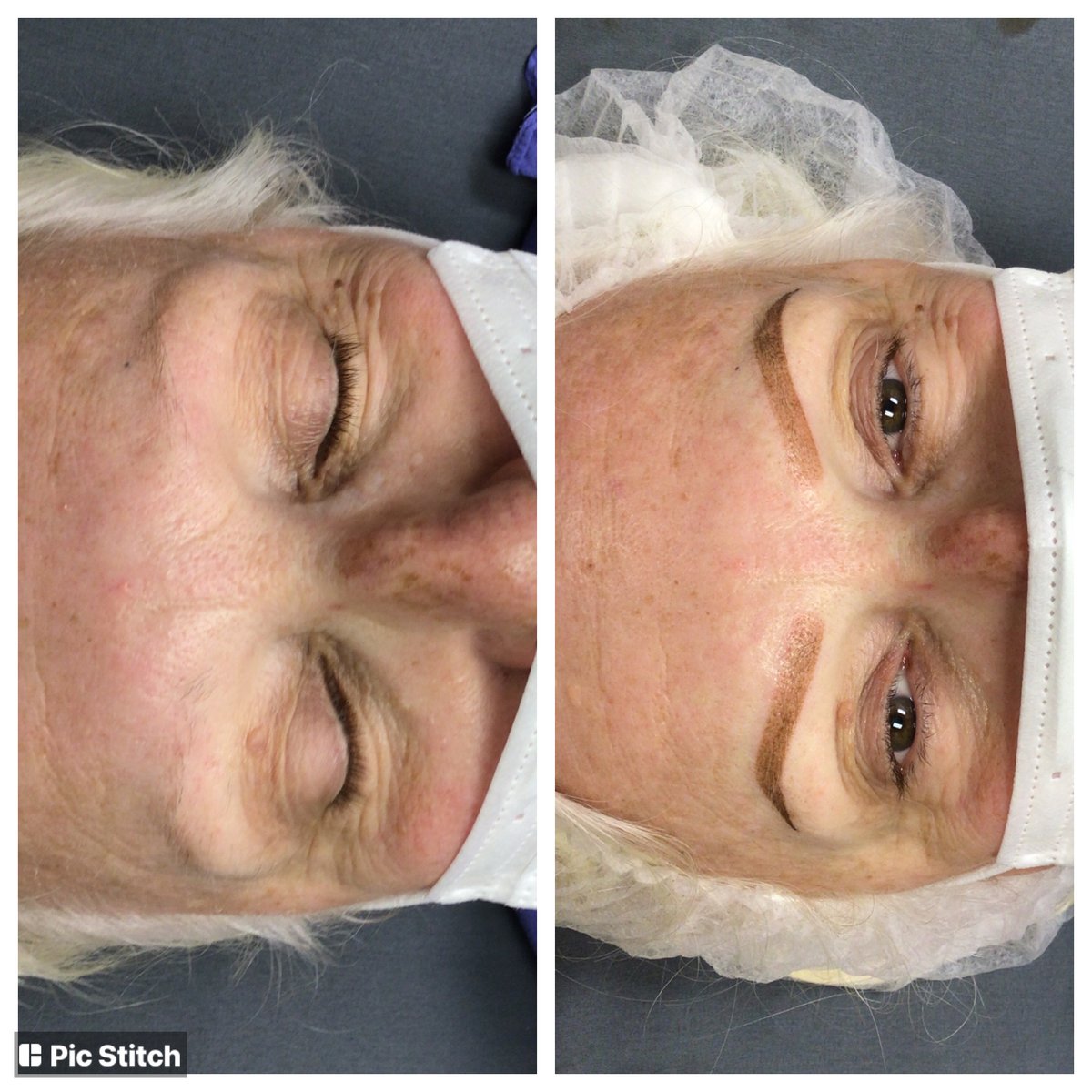 ParksDermatolog's tweet photo. Check out this before and after of a beautiful patients ombre eyebrows! 😍 An ombre eyebrow is a semi-permanent, soft shaded brow pencil look, ideal for ANY skin type! Call now to schedule your consultation 📱 (386)677-9044 #ombreeyebrows #semipermanenteyebrows #waterproofbrows https://t.co/oYiog8qWLR