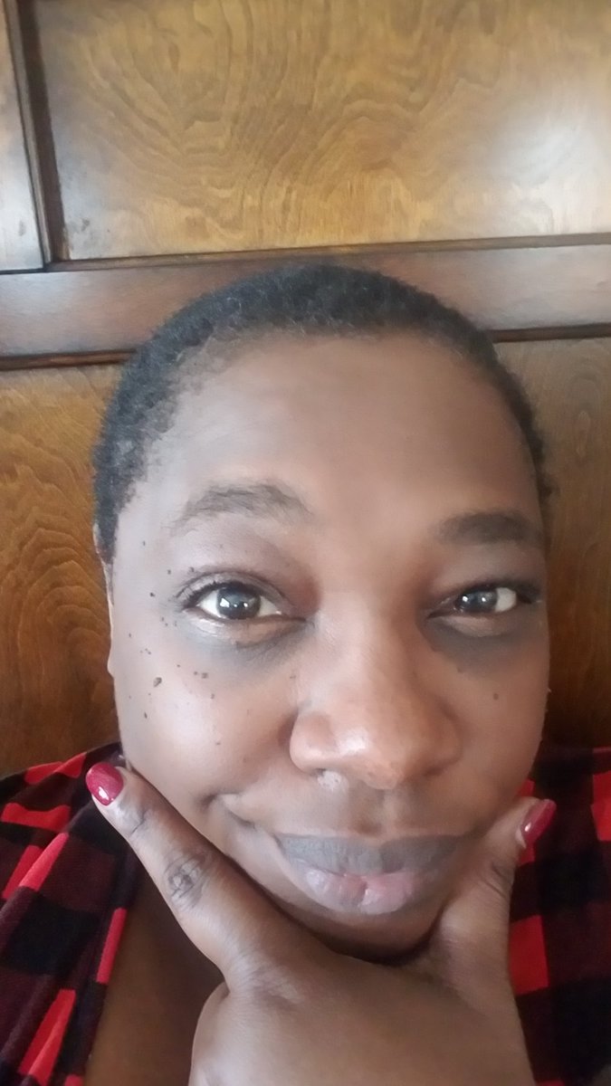 spiercerocks's tweet photo. A week ago I shaved my head due to stress and hair loss. You know what's been helpful? People problem solving and abiding with me when there are no easy answers.
#LifeFantastic #IdeaDynamo #TheseLivesMatter #DisabilityRights #ActuallyAutistic #HairLoss #BlackExcellence https://t.co/8Z4t5bhEKL
