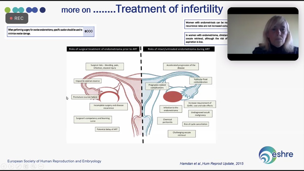 juanjo_fraire's tweet photo. Talking risks of endometriosis surgery #ESHREssentials 🤔🤔by ⁦@PaolaVigano3⁩ ⁦@ESHRE⁩ https://t.co/YHsM4vVaoK