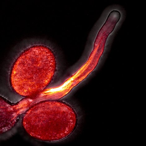 JanMartinek4's tweet photo. I just registered for The 26th International Conference on Sexual Plant Reproduction #ICSPR2022! With Petra Cifrova, we will present our results on the role of #actin #cytoskeleton in #pollentube apical growth. Looking forward the #plantreproduction science there!
#IASPRR https://t.co/4yXRqSmrWi