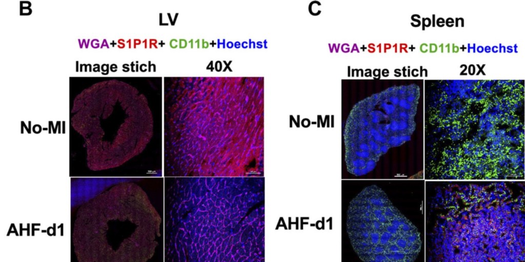 ajpheartcirc's tweet photo. Recommended Reading โฌ๏ธ
Sphingosine-1-phosphate interactions in the spleen and heart reflect extent of cardiac repair in mice and failing human hearts
https://t.co/I7H8aHI12x
#InterOrganCommunication #Spleen #Heart #Cardiorenal https://t.co/tcZq1QQpfa