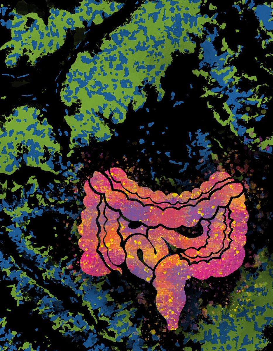 CD_AACR's tweet image. #ReverseTranscriptase Inhibition Disrupts Repeat Element Life Cycle in #ColorectalCancer by Rajurkar, @aparna1024, @bengrbm, @davetingmgh et al.
bit.ly/3tMQLYZ
@MGHCancerCenter @CompOncMSK @MSKCancerCenter #viralmimicry #clinicaltrial #ColorectalCancerAwarenessMonth