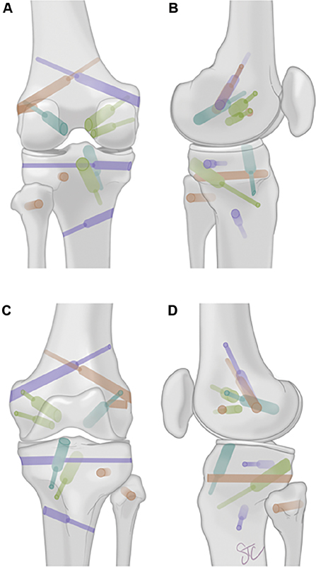 University of Missouri Orthopaedics tweet media