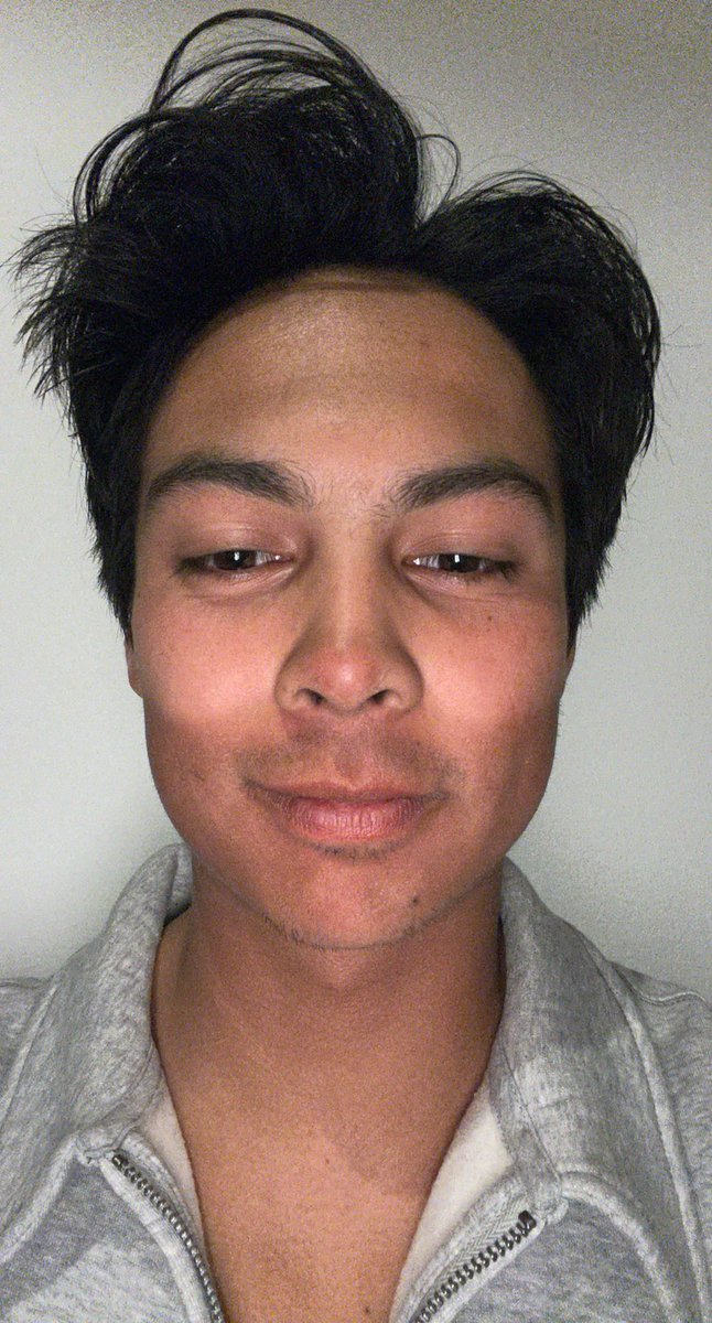 andrewzimmers2's tweet photo. For all my fellow Filipinos, still wear sunscreen when you’re on the slopes. We’re not invincible! #goggletan #filipino #sunburn #besafe #likeforlike #didyoutrythenewtwixbar https://t.co/319auX866H