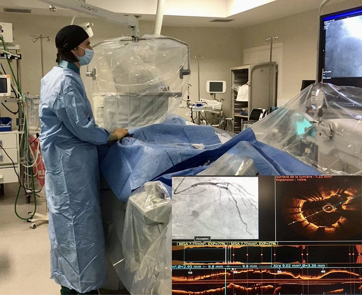 quentinlandolff's tweet photo. First Calipso today @CardioHilaire @nicolasamabile @HontonB @mattgodin1 @SouteyrandG @NicoCoombs63 @EuroInterventio @AbbottCardio @PCRonline @GACIntervention https://t.co/bHRa9mezfq