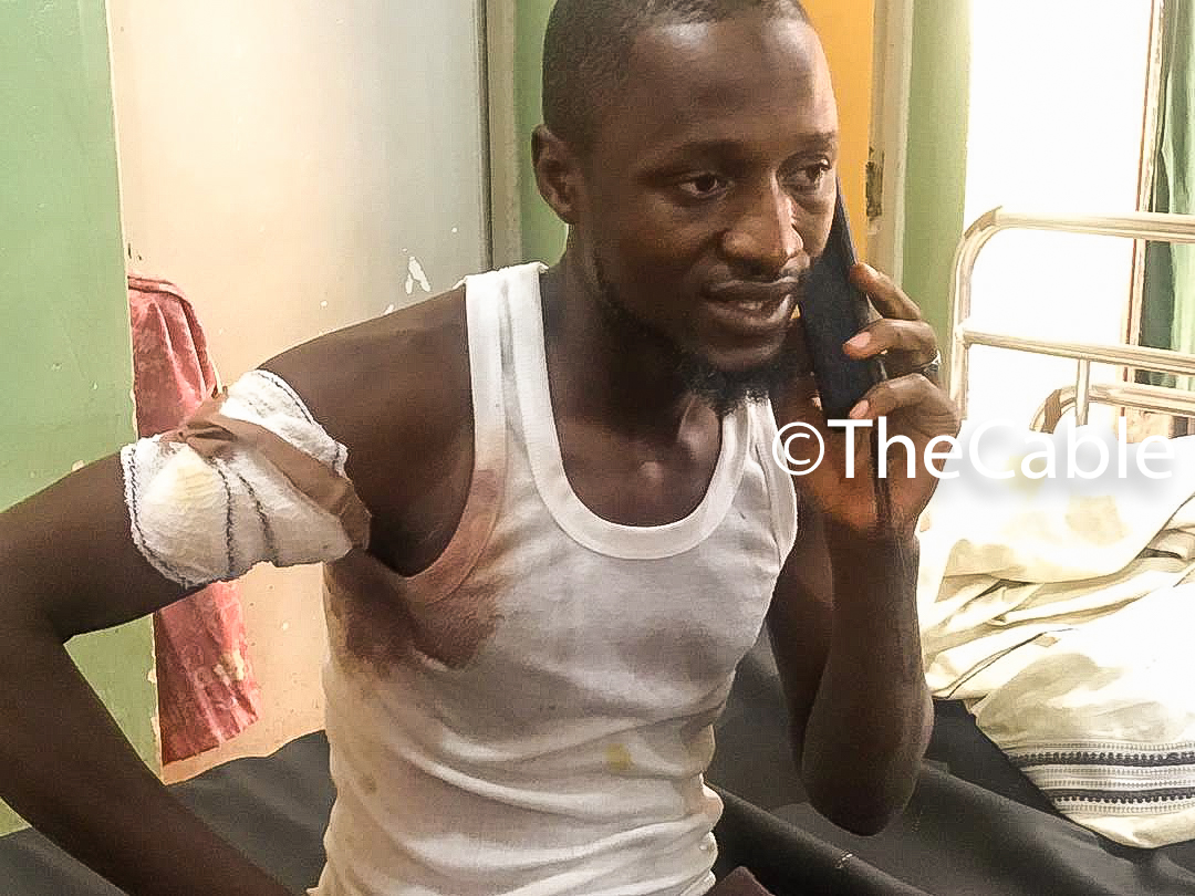 thecableng's tweet photo. ‘Soldiers carried us on their backs’ — victims of Abuja-Kaduna train attack narrate ordeal | TheCable https://t.co/cGBp2njr7f

#KadunaTrainAttack https://t.co/VQ9BUhhU3G