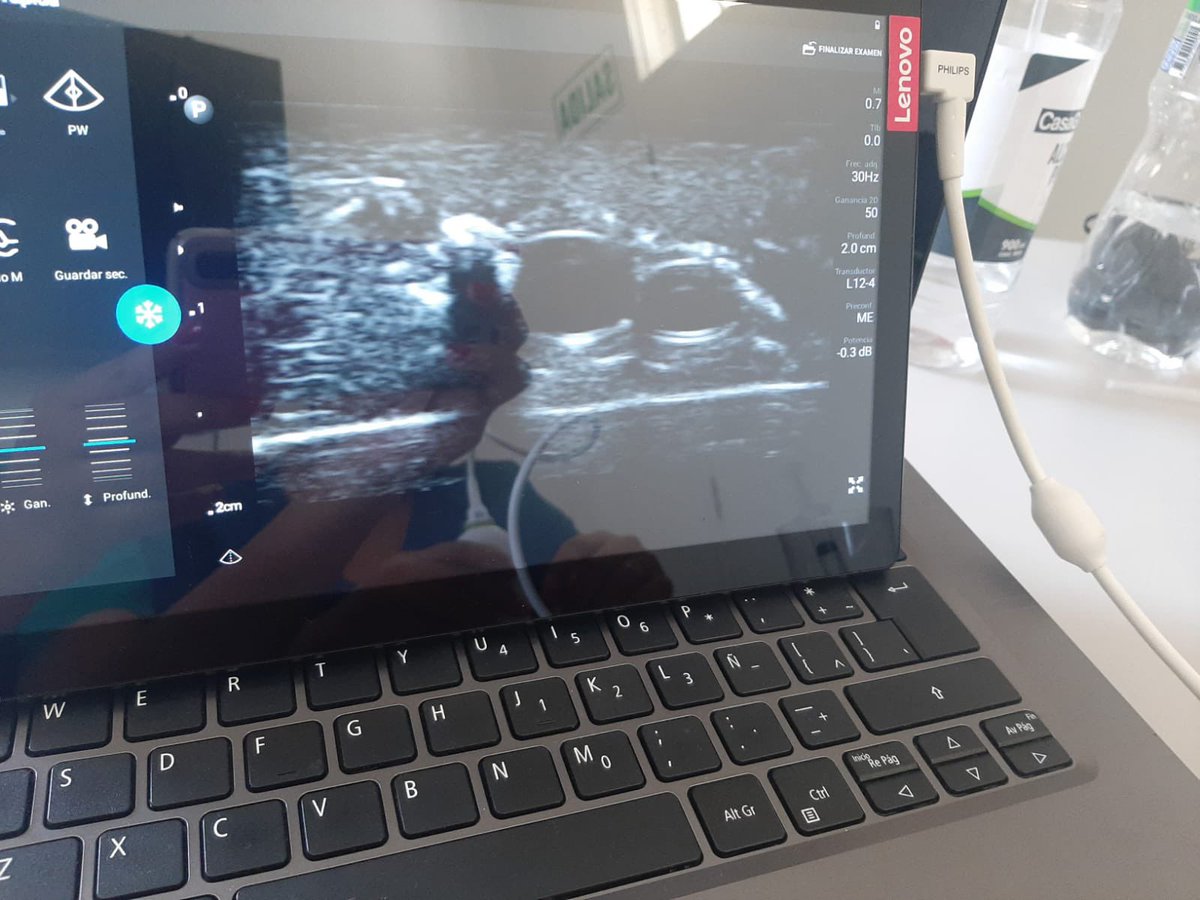 physicianSEM's tweet photo. #UPA Taller de accesos vasculares en la rotación de #UPA en Emergencia - Hospital Loyza. Gracias @ondasPOCUS @DreyfussAndrea @Dmartin07EM @PhilipsLumify @UPAndo6 @JackelineEstof1 @italo05airway @LizelyGil https://t.co/vnL1zm8XKF