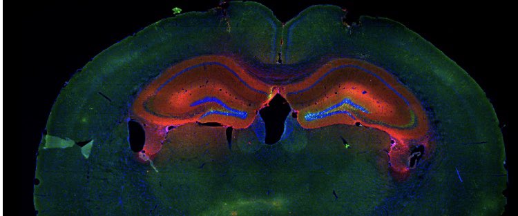 davide_coda's tweet photo. 📣Are you interested in studying the molecular basis of memory extinction? A master student position is available in @GraeffJohannes lab at @Brainmind_EPFL to work with me on this exciting project! All the details 👇 https://t.co/Ew4DQVtwOw Please RT! #neuroscience #PTSD #brain https://t.co/Tb5HsMWYXg