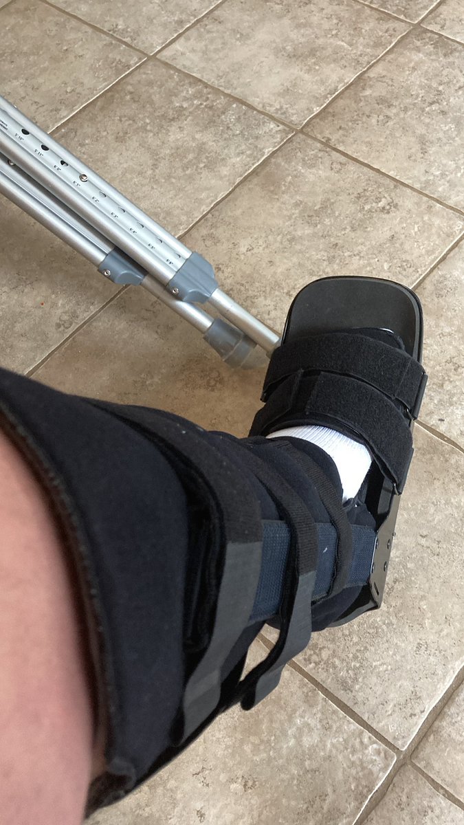 Day 16, got my boot and had my first physio appointment. Crazy swelling in my ankle when the cast came off…#achilles