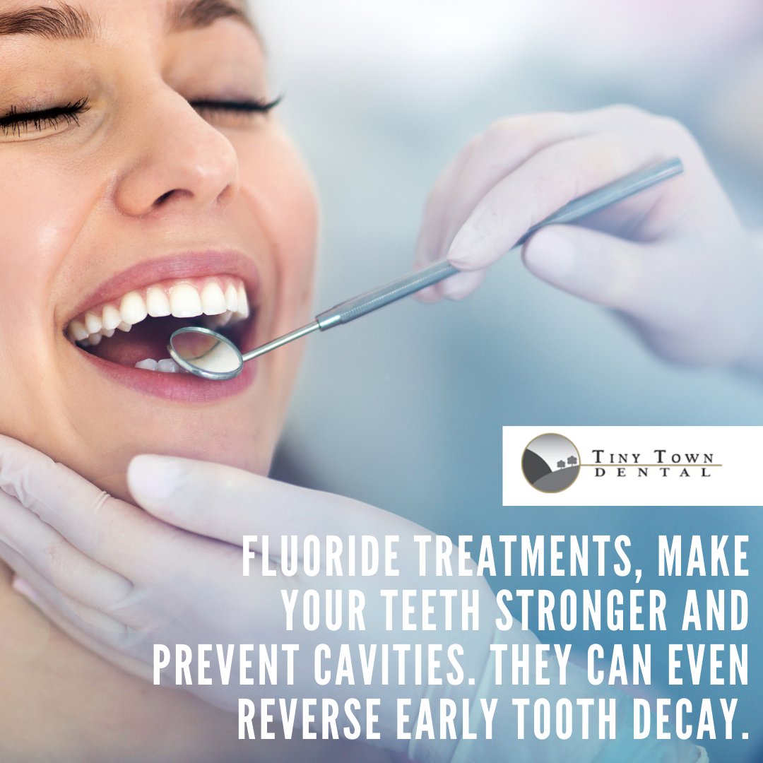 Fluoride treatments, make your teeth stronger and prevent cavities. They can even reverse early tooth decay. 
#tinytowndentist #tinytowndental #oralhealth #dentist #familydentist #dentalsealants #fluoridetreatment