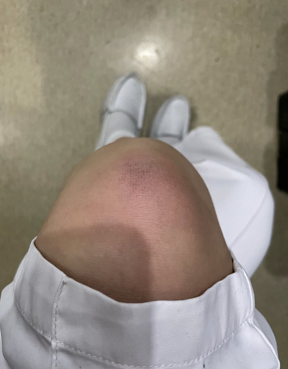 XxBonte's tweet photo. 别的m的伤都是被SP来的，我的是一天一跤摔的 差距怎么那么大
#小母狗 #文爱 #骚逼 #露出 #制服诱惑 #护士制服 #原味棉袜 #原味 #深喉 https://t.co/l9tF4Fp9Pi