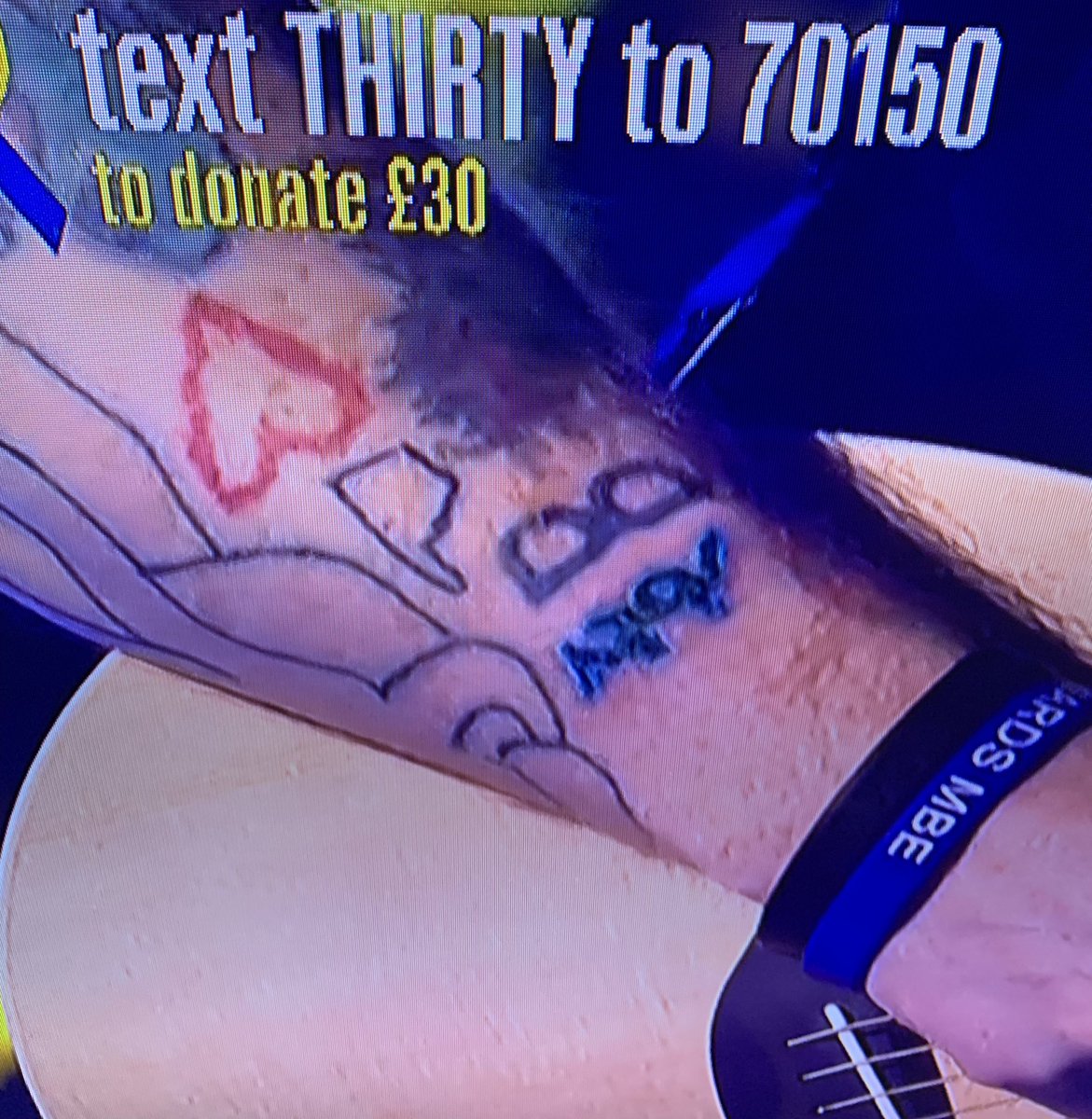 livreports's tweet photo. I really like Ed Sheeran. But why has he had “poo” tattooed on his arm? #ConcertForUkraine #edsheeran https://t.co/CmtEIf6SYx