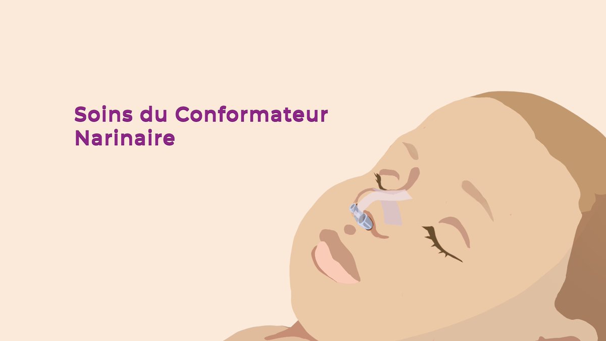 FiliereTETECOU's tweet photo. 🎬 [Nouvelles vidéos pédagogiques]
Le Centre de Référence des #Fentes et malformations faciales (#MAFACE) a développé 2 vidéos pédagogiques : soins de l'#orthèse palatine et du #conformateur narinaire des enfants porteurs de #fentes.
👉 https://t.co/epf1ZovT3S
#maladiesrares https://t.co/saL0vaXdOU