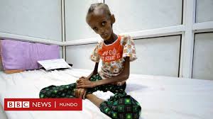 WENCESLAORAMI14's tweet photo. @eleconomista 6 años de invasión saudí en Yemen mueren cientos de niños de hambre y todos callan. https://t.co/KBIYkw99SC