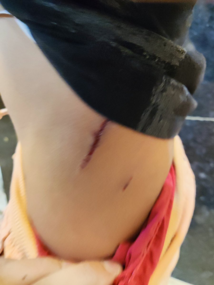 cybersaini's tweet image. @peta what is the objective of your organization? Stray dogs menace in the residential societies is a big problem now and every now n then kids are bitten up. Few people in the name of peta create nuisance, they don&apos;t think about small kids and elders in the residential premise.