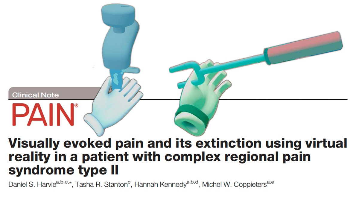 The intriguing case of pain evoked by visually simulated touch, without actual mechanical stimulation. Team: <a href="/michelcoppie/">Michel Coppieters</a> <a href="/Tash_Stanton/">A/Prof Tasha Stanton</a> <a href="/hannahkennedyOT/">Hannah Kennedy</a> <a href="/unisaresearch/">UniSA Research</a> <a href="/Griffith_Uni/">Griffith University</a>!
pubmed.ncbi.nlm.nih.gov/35297803/