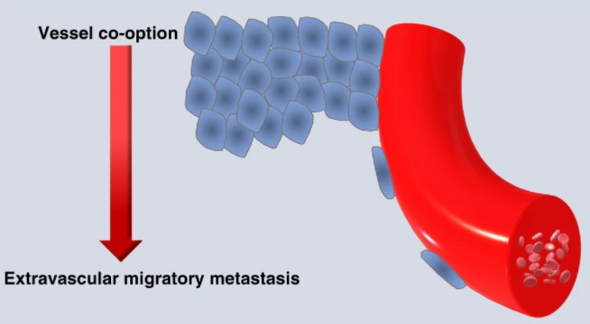 The vascular outsiders

Read the editorial for free: rdcu.be/cKaSW

#Mechanismsofdisease #Metastasis