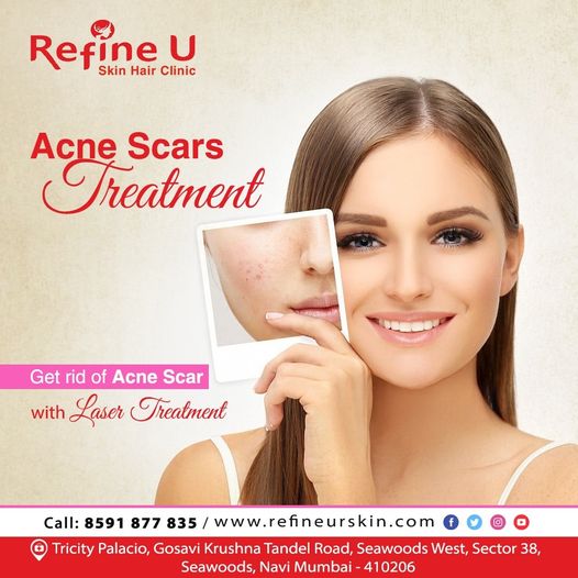 refine_u's tweet photo. Get rid of Acne Scars! 
Consult at Refine U Seawood Navi Mumbai India. 
. 
. 
 #acnescars #acne #acnetreatment #acneproneskin #acnescarsremoval #DrRashami #refineu #seawood #NaviMumbai https://t.co/hFpmWpsgLZ