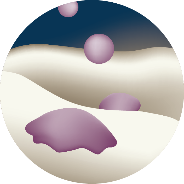 #boneregeneration #tissueregeneration #mbcptechnology 
#step7 #graft #resorption #graftresorption
Step seven in the bone regeneration process is graft resorption: the phase when osteoclasts resorb the graft, releasing ions and growth factors previously absorbed.
#knowledgesharing
