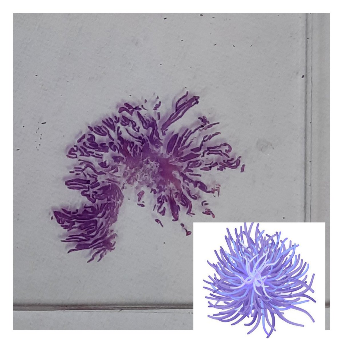 #Pathart #Polyp #GIPath