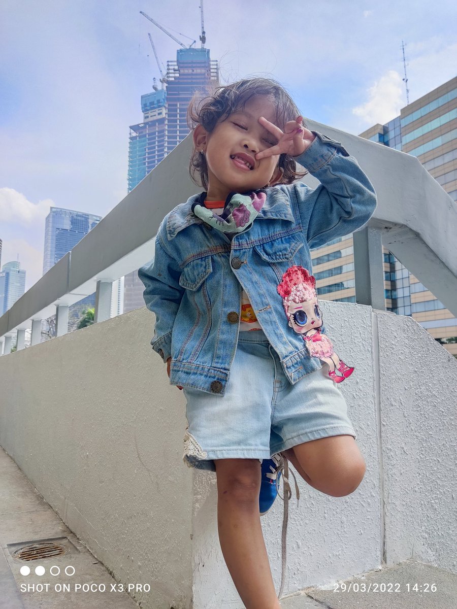 Yang pesek yg menarik!🤩🥰