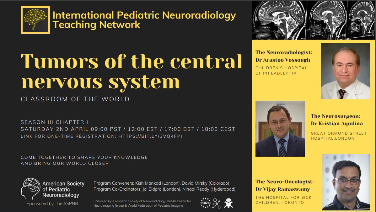 Tumors of the Central Nervous System: Saturday, April 2nd: 9:00 PST/12:00 EST/ 17:00 BST /18:00CEST Register at the link: bit.ly/3vq4FPI