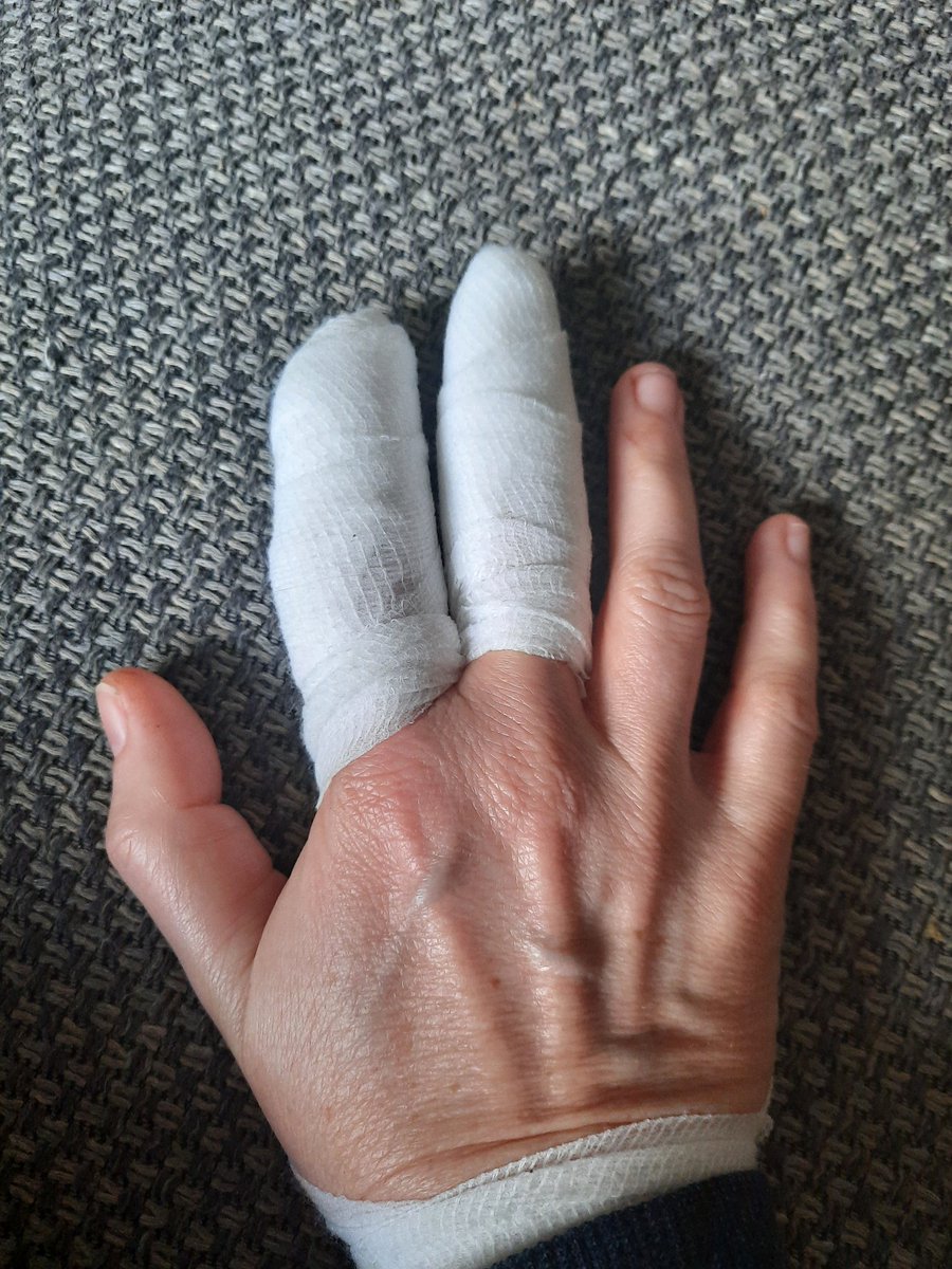 De messen die je bij de <a href="/JumboSupermarkt/">Jumbo Supermarkten</a> kunt sparen zijn scherp!