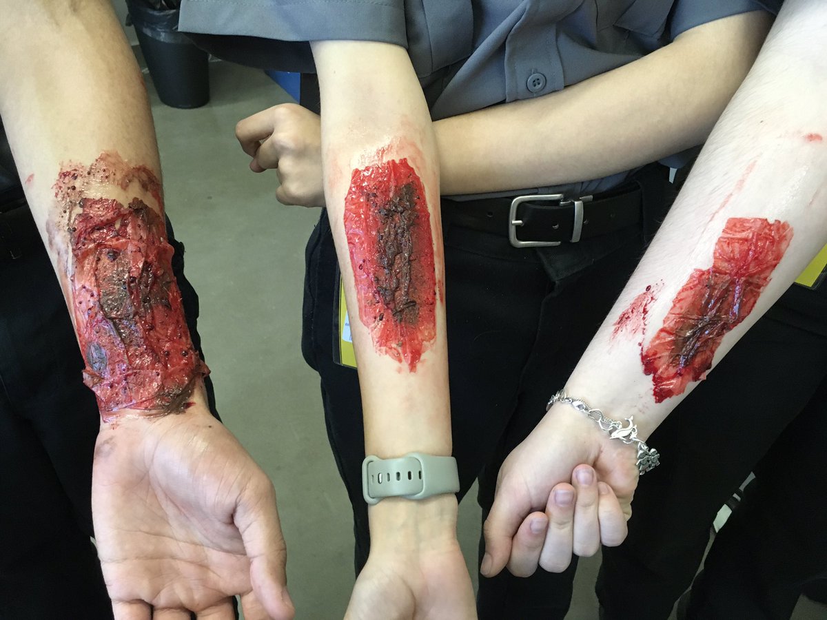 GRCTC_EMT's tweet photo. #moulage #EMT @GR_CTC https://t.co/HyWWGs6lX1