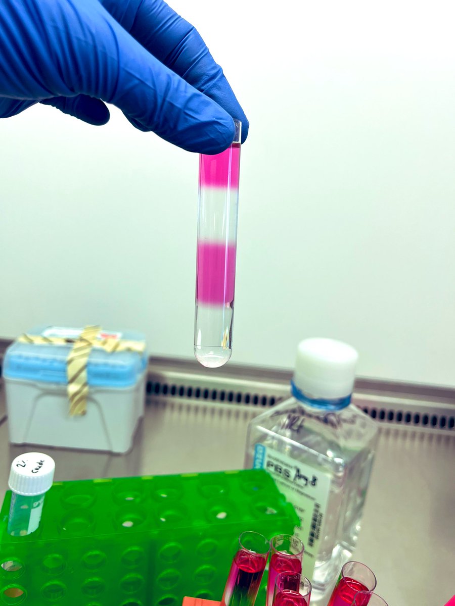 AmyByrne14's tweet photo. My #Ev preparation on top of my density gradient. It’s time consuming but satisfying, now for 16 hours at 100,000g ! #EVs #Exosome #ExosomeIsolation #DensityGradient #UltraCentrifugation #phdlife #PhDVoice https://t.co/13Lr3A0dms