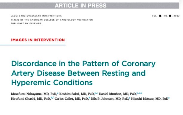monaltiren's tweet photo. #CoronaryPhysiology
& pattern of CAD
#NHPRs vs. #FractionalFlowReserve
@jaccjournals https://t.co/xj9JJjf4QL
@ColletCarlos @DMunhoz M Nakayama, K Sakai, H Ohashi, NP Johnson, H Matsuo https://t.co/QDdUAS6r3V
