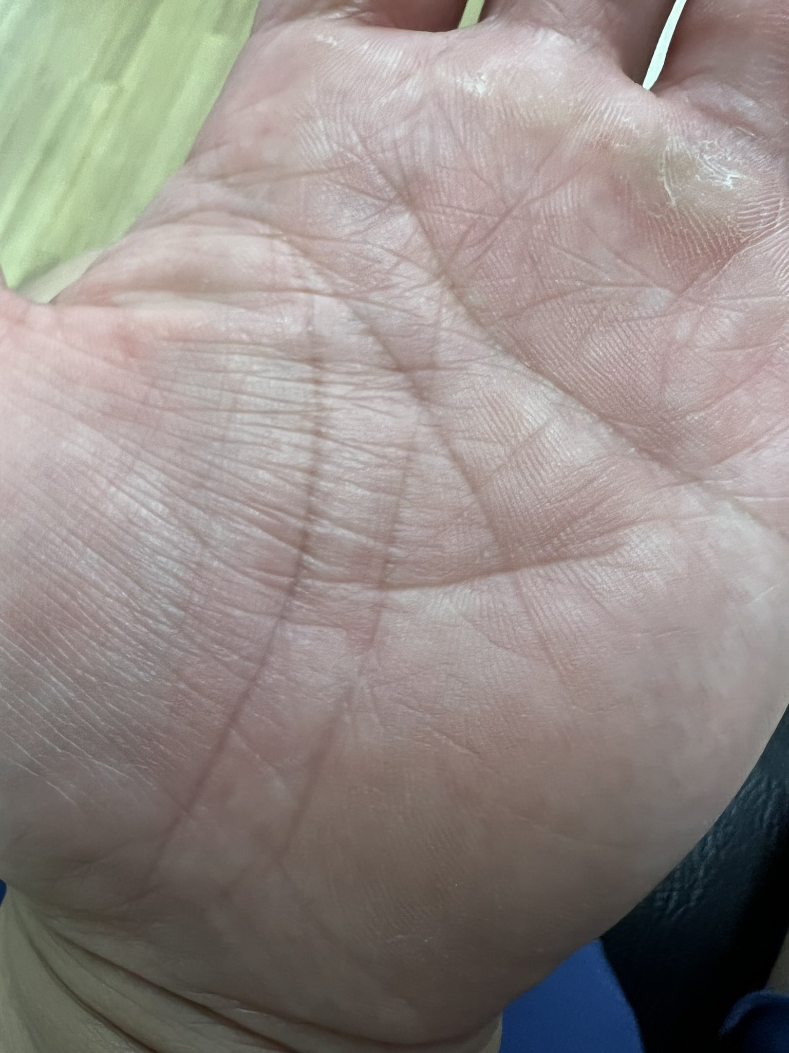 تويتر 突然ですが占ってもいいですか على تويتر 突然ですが占ってもいいですか ご視聴ありがとうございます 手相で素顔と人生が明らかに 放送の中で ある方が800人に1人にしかない 天下を獲る相 覇王線を持っていました 皆さんには覇王線