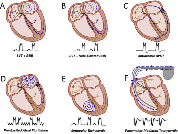 Dr. Kevin Harris (@bcchheartcentre) on Twitter photo 
