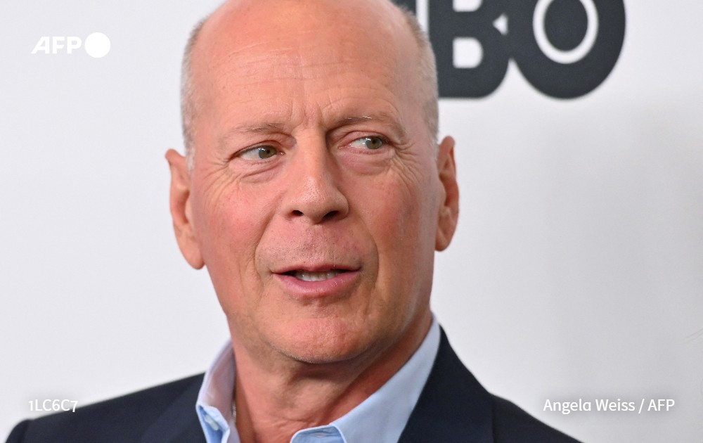 CerfiaFR's tweet photo. 🚨🇺🇸 FLASH | L’acteur américain Bruce #Willis est atteint d’aphasie. Il annonce mettre fin à sa carrière.

(AFP) #BruceWillis https://t.co/lqevmGFQvb