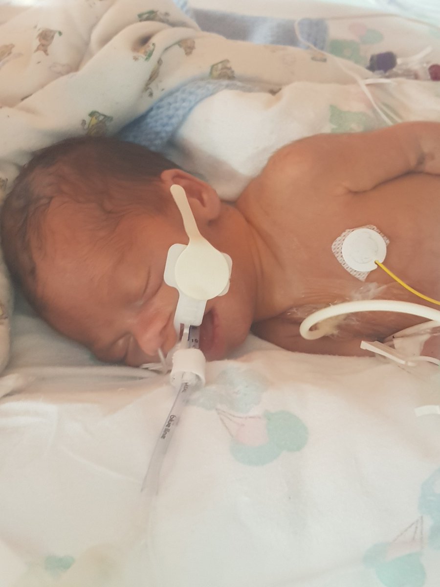 Please please pray for my little Noah, hes fighting for his life in the ICU and things arent going so well. We need a miracle 💔