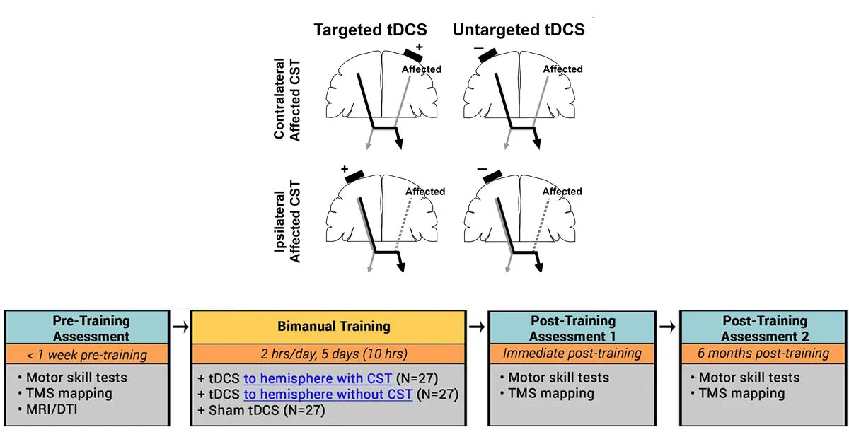 An innovative pilot study by Friel Lab <a href="/BurkeNeuroSci/">Burke Neurological Institute</a> and collaborators <a href="/CPcenter_TC/">Center for Cerebral Palsy Research</a> on HABIT combined with tDCS can improve impaired upper extremity muscles and motor function is now published in full-text on Pub-Med.
#cerebralpalsyawarenessmonth 
buff.ly/3qtSvUX
