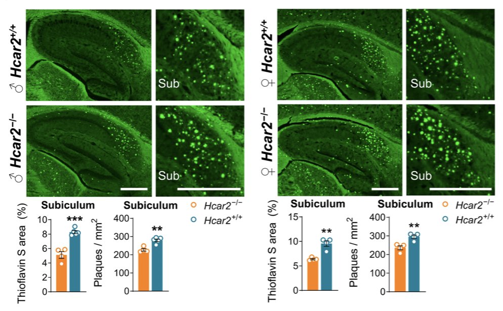 ScienceMagazine's tweet photo. An approved formulation of the vitamin #Niacin slows the death of neurons and the progression of #AlzheimersDisease in mice by correcting #Microglia, according to new research in @ScienceTM. #Neurology https://t.co/p2fOxYHLLO https://t.co/2Gpi5L87xv