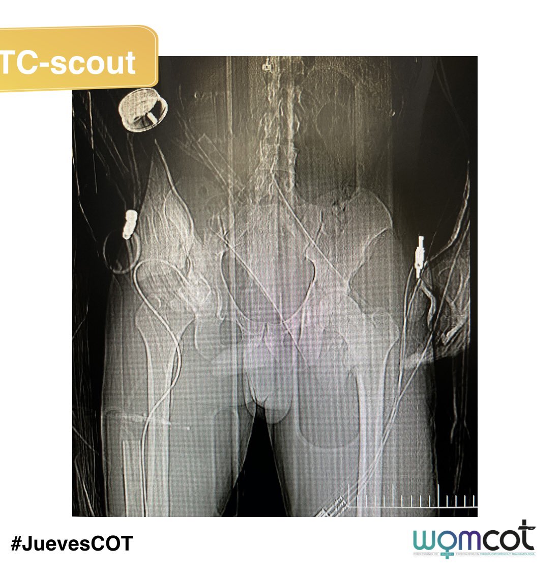 Womcot Spain tweet media