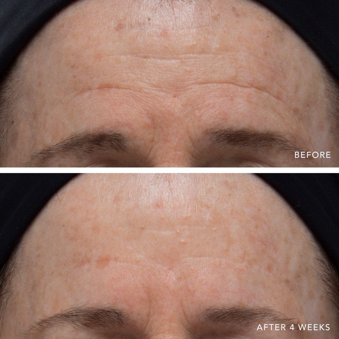 One month, three simple steps.

We will never get tired of the transformative results from just 30 days of using The Lancer 3-step Method.

There's no better time to start than now—save 20% on The Method during our anniversary sale. Shop and save at bit.ly/TheMethodAnniv…