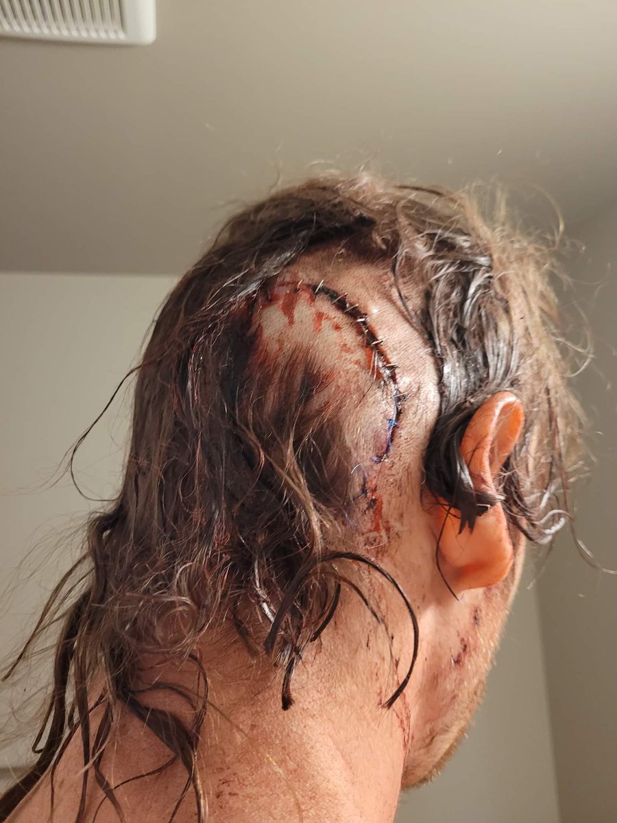 LlDutch's tweet photo. The police are so corrupt I am only one getting charged in my attempted murder... https://t.co/ots2EVwJx6