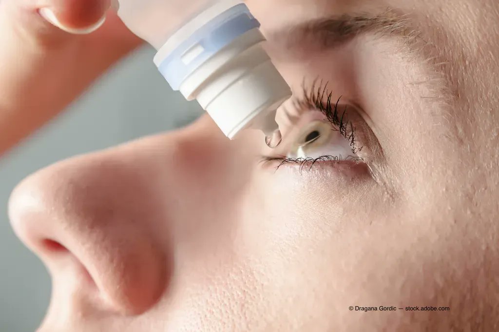 OphthTimes's tweet photo. How novel autoantibodies may improve screening #DryEye patients for Sjogren's syndrome: https://t.co/VHVi8ckRv4
#ophthalmology #Sjogrens #PatientCare #Ocular #Cornea #Clincal https://t.co/lYQZgbOVUn