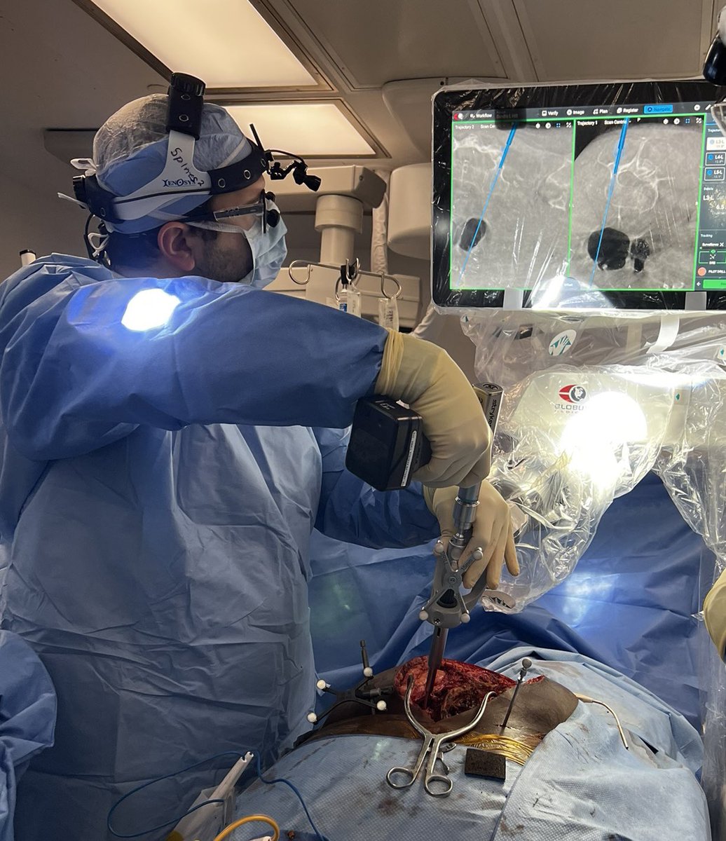 AhilanSiva's tweet photo. Elias Atallah, rockstar resident @TJUHNeurosurg, placing robotic pedicle screws at #JeffersonMethodist.

Combined neuro-ortho surgery for spinal deformity. Burgeoning collab with Alex Vaccaro and @RothmanOrtho

The era of silos is over. @AshSharan @PascalJabbourMD @GlobusMedical https://t.co/HAZsvRYg9k