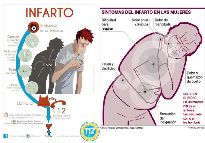 guardiacivil's tweet photo. ¡Cada segundo cuenta en un ataque de infarto! ⏰ Llegado el caso ¿Sabrías reconocer los síntomas y qué hacer para contrarrestarlo? 

🔴SÍNTOMAS ⬇
Fatiga y debilidad
Dificultad para respirar
Sensación de indigestión
Dolor en la clavícula/mandíbula
Dolor quemazón en el cuello https://t.co/FOy5AAdIqz