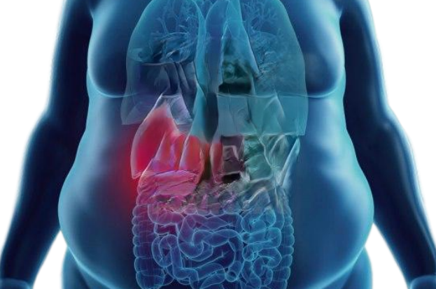 Hígado Graso No Alcohólico - fuerakilos.com/blog/higado-gr…