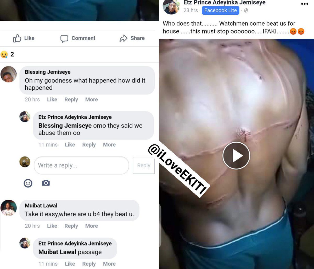 iLoveEKITI's tweet photo. CHECK OUT HOW THIS GUY WAS ALLEGEDLY BEATEN BY WATCHMEN IN IFAKI EKITI FOR ABUSING THEM..

 A GOOD JUDGEMENT? https://t.co/fn2XT5nIw8