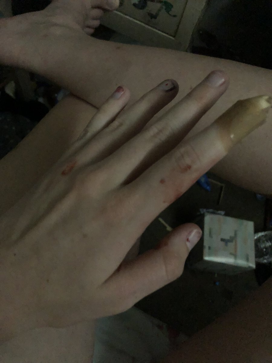 this_is_a_vent's tweet photo. Tw/blood. I kinda accidentally stabbed myself https://t.co/azTAP7JHdJ