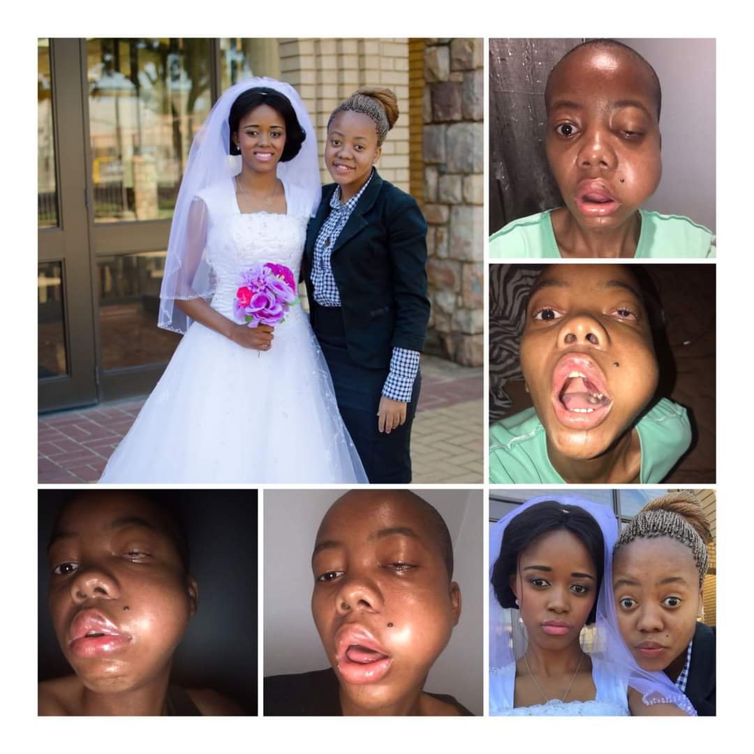 LadyNqobi's tweet photo. Zanele we praying with you for your healing https://t.co/qe1Qvy5X0g